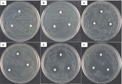 Inhibitory effect of vanillin on Pseudomonas syringae pv. actinidiae of kiwifruit surface and its effect on the quality of fruits